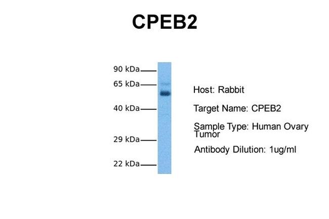 CPEB2 Antibody in Western Blot (WB)