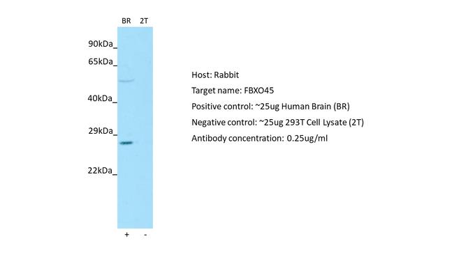 FBXO45 Antibody in Western Blot (WB)