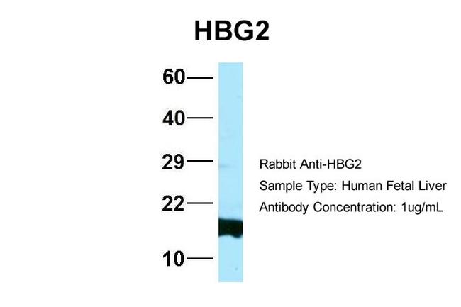 HBG2 Antibody in Western Blot (WB)