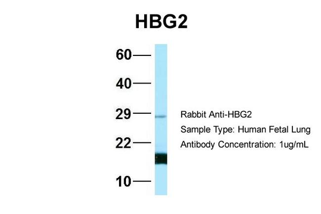 HBG2 Antibody in Western Blot (WB)