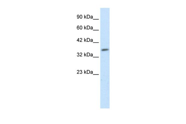 HEYL Antibody in Western Blot (WB)