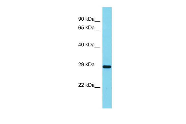 IRAK1BP1 Antibody in Western Blot (WB)