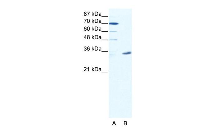 MAGEA9 Antibody in Western Blot (WB)