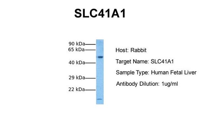 SLC41A1 Antibody in Western Blot (WB)