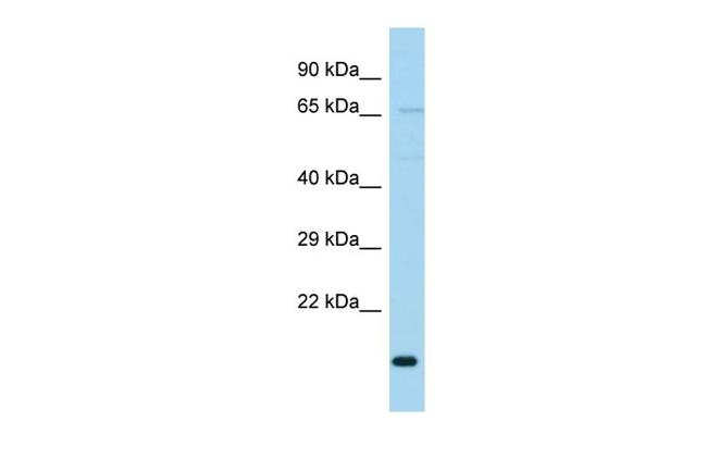 TIMM23B Antibody in Western Blot (WB)