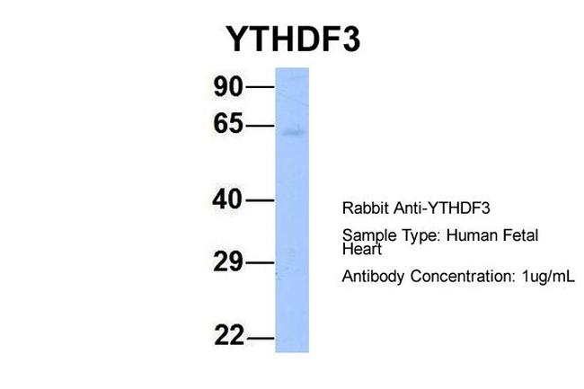 YTHDF3 Antibody in Western Blot (WB)