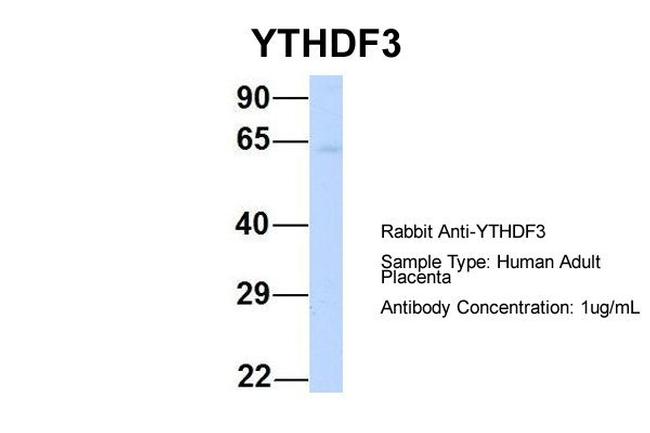 YTHDF3 Antibody in Western Blot (WB)