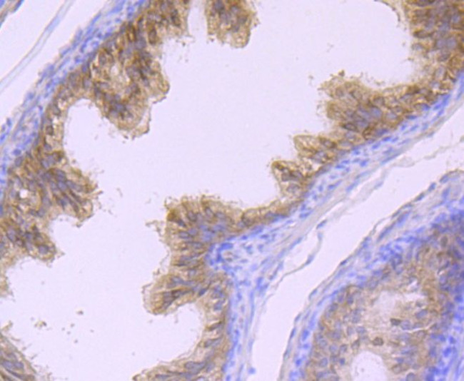 MSI2 Antibody in Immunohistochemistry (Paraffin) (IHC (P))