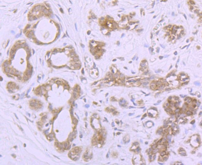 MSI2 Antibody in Immunohistochemistry (Paraffin) (IHC (P))