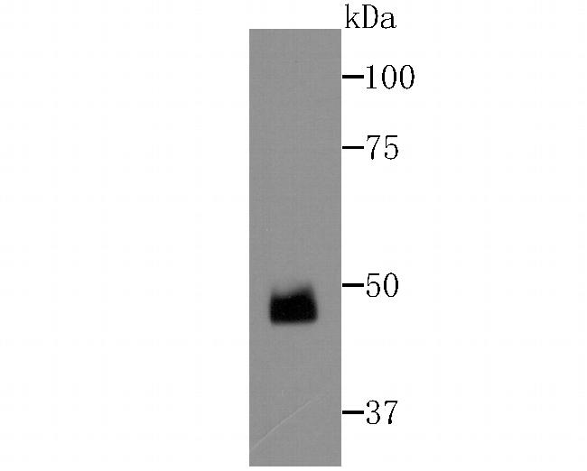 ZNF312 Antibody in Western Blot (WB)