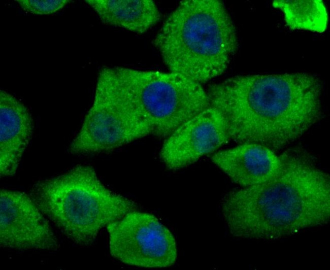 HIP1 Antibody in Immunocytochemistry (ICC/IF)