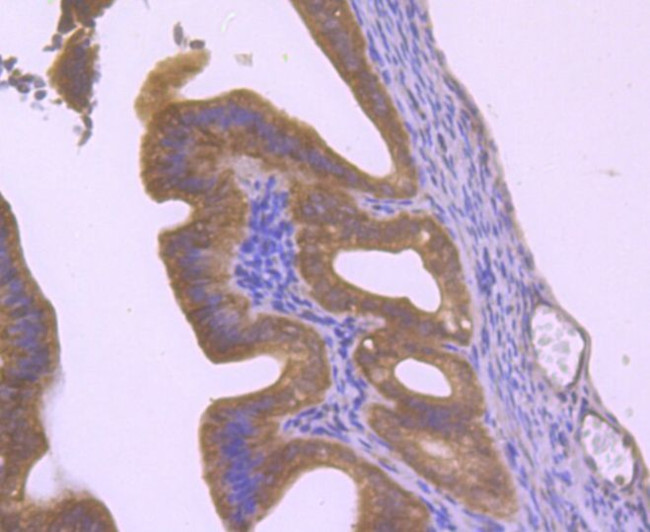 HIP1 Antibody in Immunohistochemistry (Paraffin) (IHC (P))