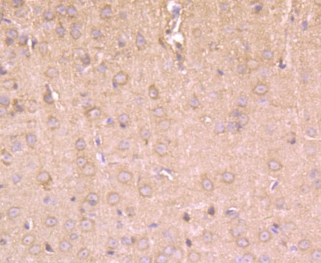 HIP1 Antibody in Immunohistochemistry (Paraffin) (IHC (P))