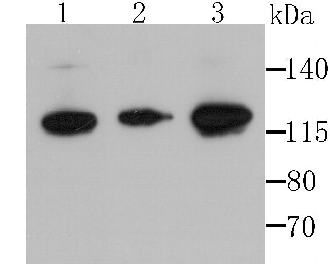 HIP1 Antibody in Western Blot (WB)