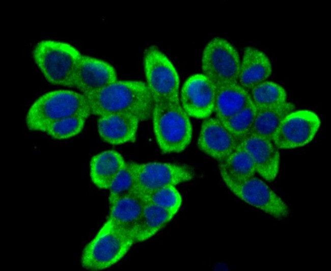 DIAPH3 Antibody in Immunocytochemistry (ICC/IF)