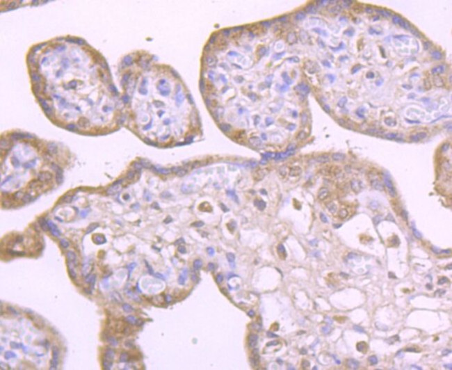 DIAPH3 Antibody in Immunohistochemistry (Paraffin) (IHC (P))