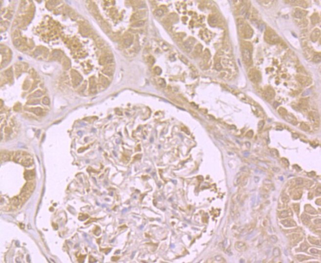 DIAPH3 Antibody in Immunohistochemistry (Paraffin) (IHC (P))