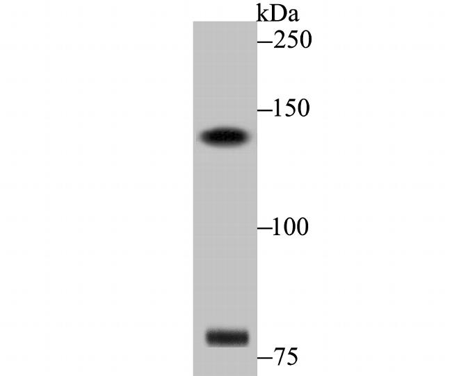 DIAPH3 Antibody in Western Blot (WB)