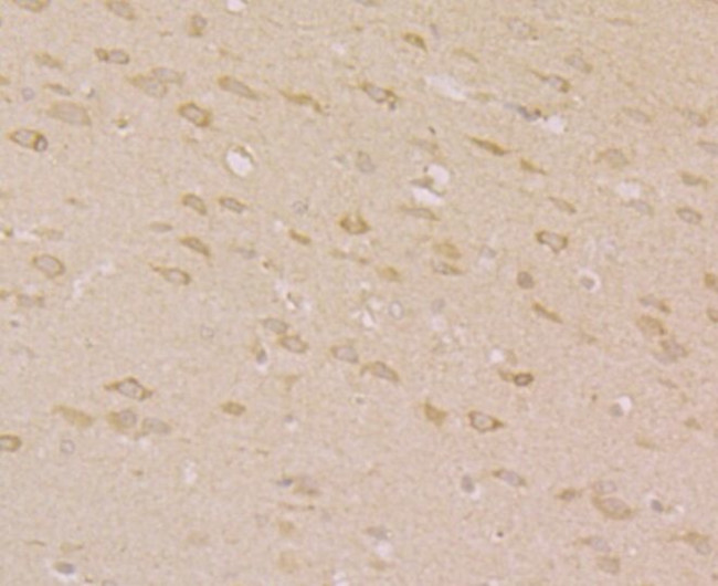 ORAI3 Antibody in Immunohistochemistry (Paraffin) (IHC (P))