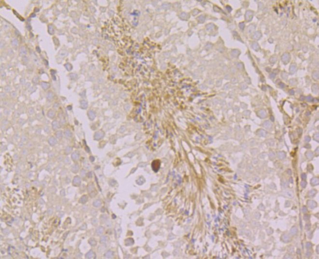 ORAI3 Antibody in Immunohistochemistry (Paraffin) (IHC (P))