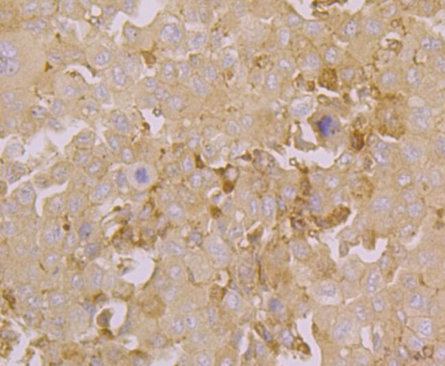 ORAI3 Antibody in Immunohistochemistry (Paraffin) (IHC (P))