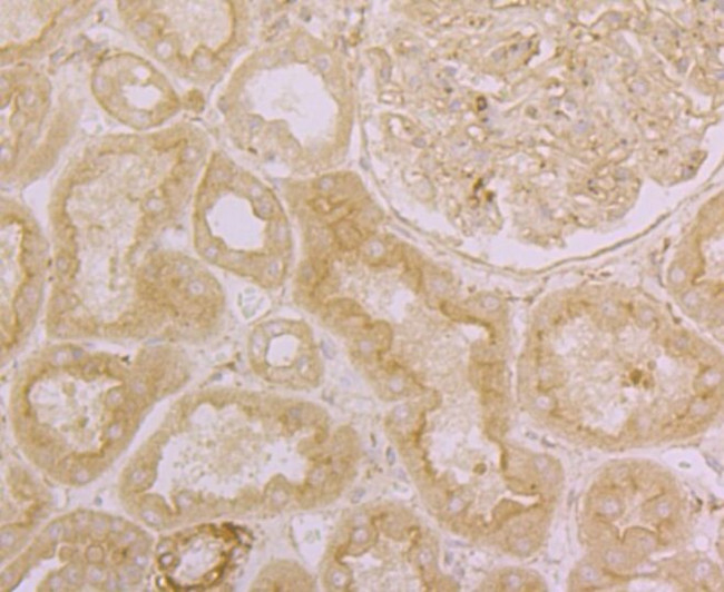 ORAI3 Antibody in Immunohistochemistry (Paraffin) (IHC (P))