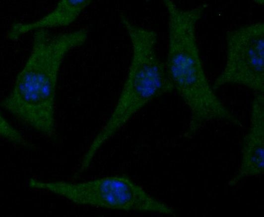 CACNG4 Antibody in Immunocytochemistry (ICC/IF)