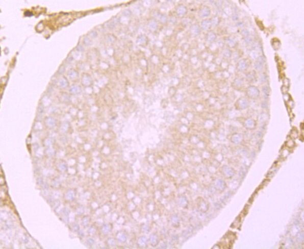 CACNG4 Antibody in Immunohistochemistry (Paraffin) (IHC (P))