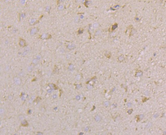 CACNG4 Antibody in Immunohistochemistry (Paraffin) (IHC (P))