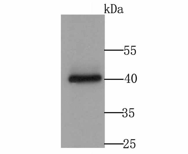 CACNG4 Antibody in Western Blot (WB)