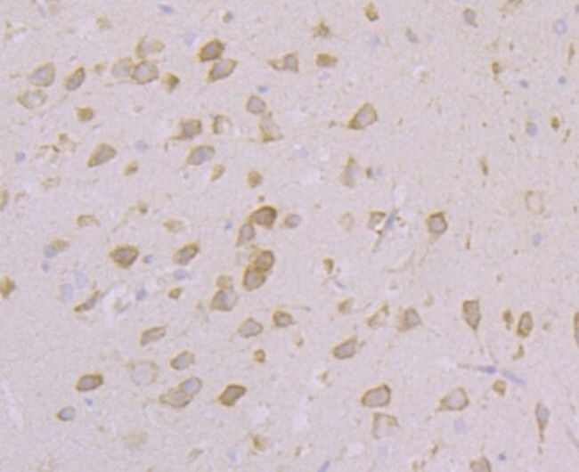 CACNB3 Antibody in Immunohistochemistry (Paraffin) (IHC (P))