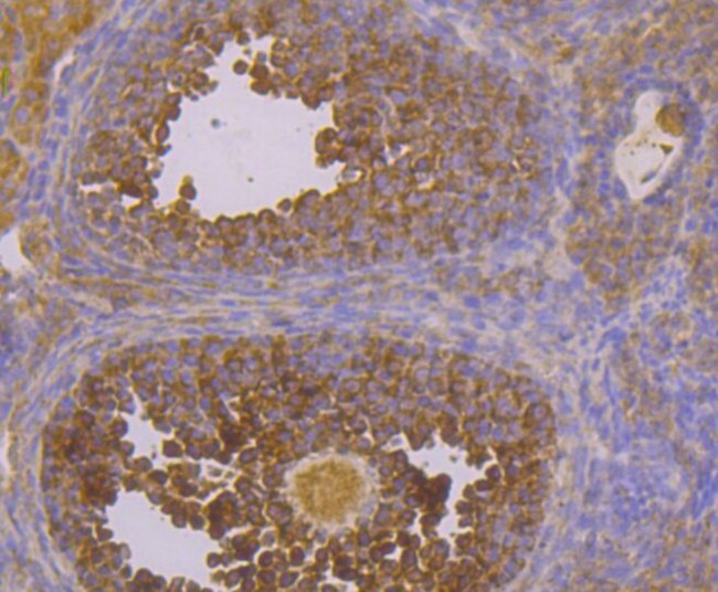 CACNB3 Antibody in Immunohistochemistry (Paraffin) (IHC (P))