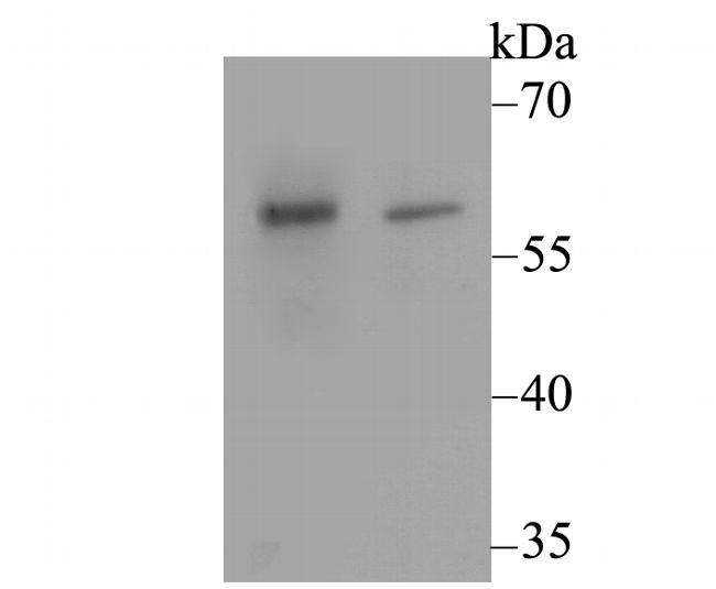 CACNB3 Antibody in Western Blot (WB)