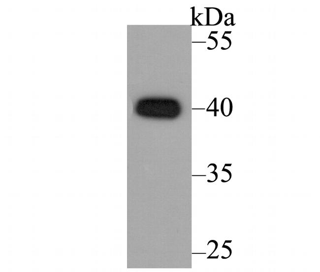 CACNG5 Antibody in Western Blot (WB)