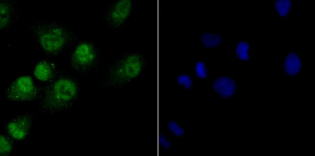 NFIC Antibody in Immunocytochemistry (ICC/IF)