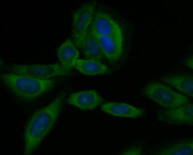 CD40 Antibody in Immunocytochemistry (ICC/IF)