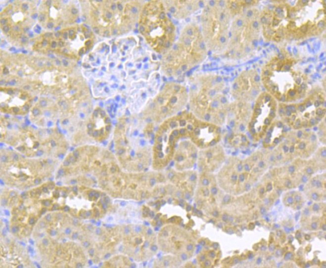 gamma-ENaC Antibody in Immunohistochemistry (Paraffin) (IHC (P))