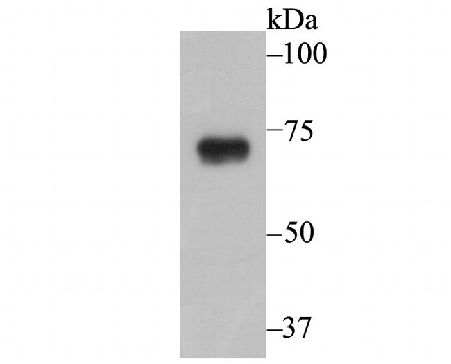 gamma-ENaC Antibody in Western Blot (WB)