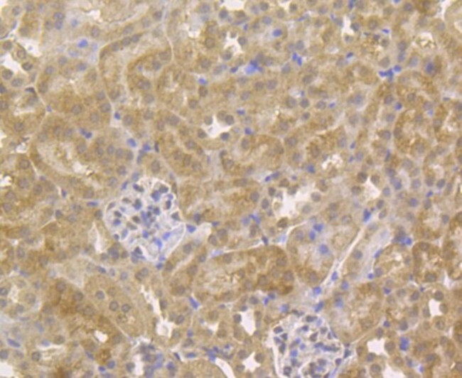 GPR30 Antibody in Immunohistochemistry (Paraffin) (IHC (P))