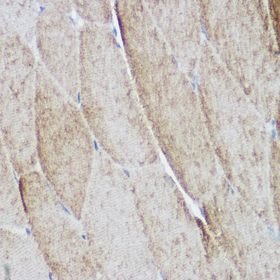 alpha Actinin 3 Antibody in Immunohistochemistry (Paraffin) (IHC (P))