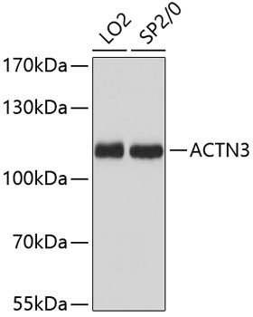 alpha Actinin 3 Antibody in Western Blot (WB)
