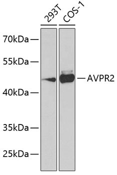 AVPR2 Antibody in Western Blot (WB)