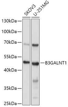 B3GALNT1 Antibody in Western Blot (WB)