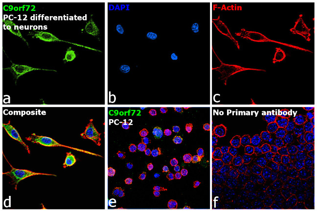 C9orf72 Antibody in Immunocytochemistry (ICC/IF)