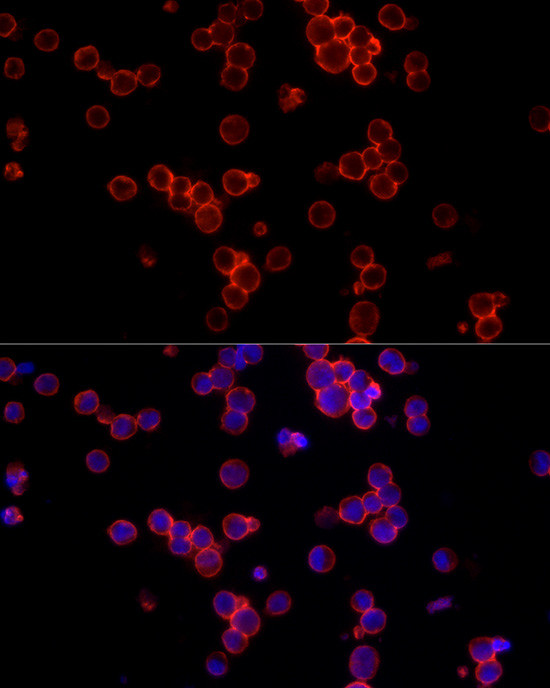 CD19 Antibody in Immunocytochemistry (ICC/IF)