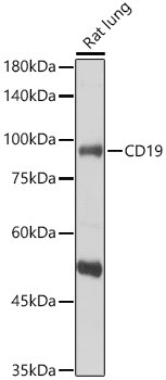 CD19 Antibody in Western Blot (WB)