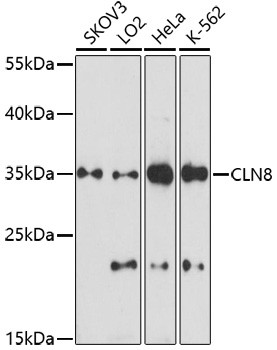 CLN8 Antibody in Western Blot (WB)