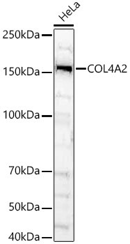 COL4A2 Antibody in Western Blot (WB)