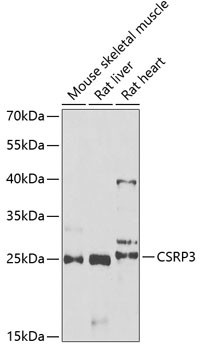 CSRP3 Antibody in Western Blot (WB)