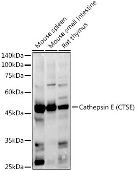 Cathepsin E Antibody in Western Blot (WB)